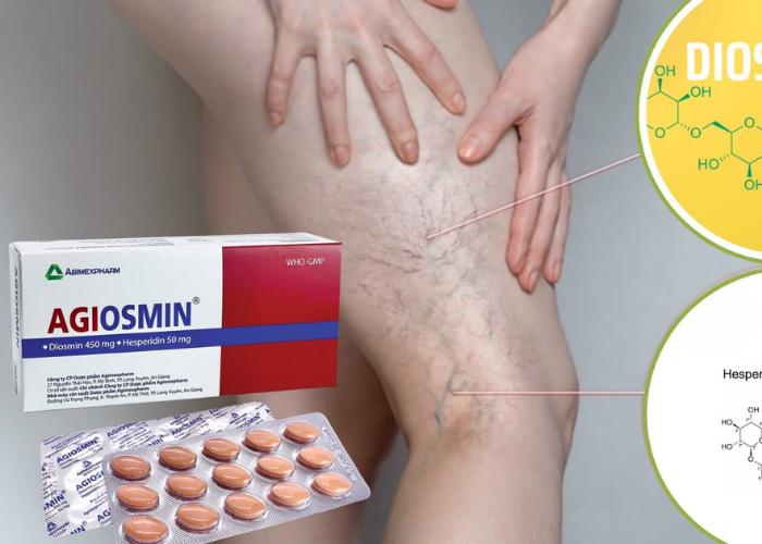 Thuốc Agiosmin Agimexpharm điều trị suy tĩnh mạch mạn tính (4 vỉ x 15 viên)