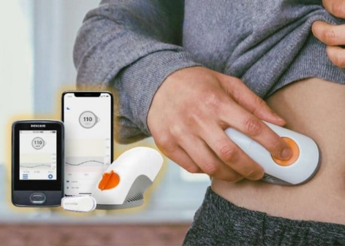  Máy đo đường huyết Dexcom G6 CGM tự động không cần lấy máu 