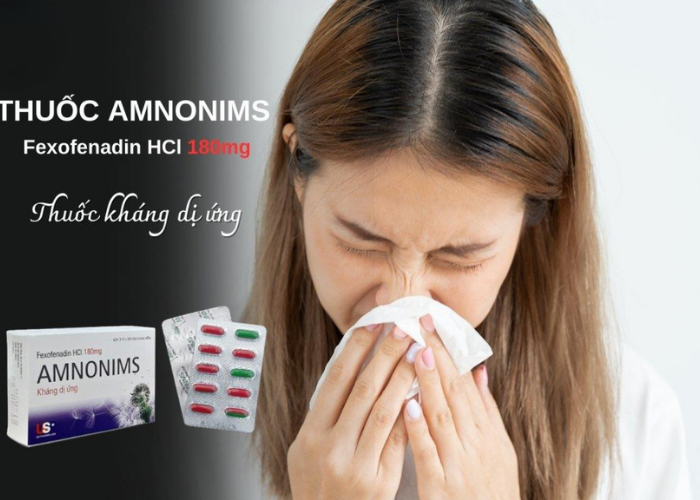 Viên nang Amnonims 180mg điều trị các chứng của viêm mũi dị ứng, mề đay (3 vỉ x 10 viên)