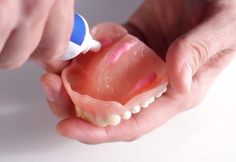 Keo dán răng giả Long Châu có bán không? Gợi ý địa chỉ uy tín