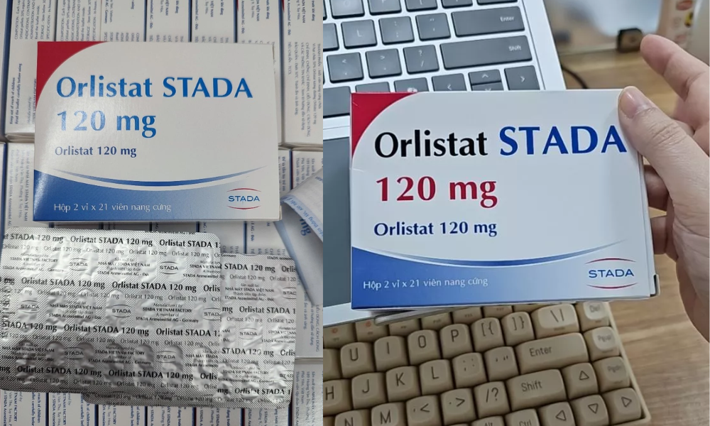 Review Orlistat 120mg Stada Về Hiệu Quả Giảm Cân